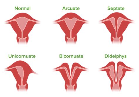 abnormal clitoris